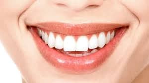 Imagen de referencia para diseño de sonrisa